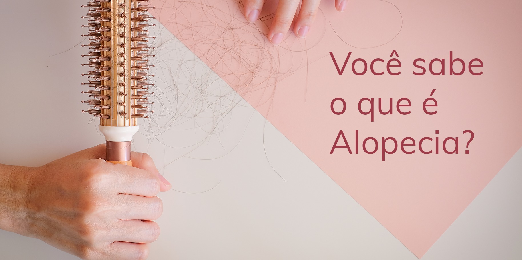 alopecia